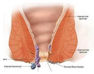 阜阳兆岐肛肠医院 阜阳兆岐肛肠医院